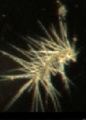 Spiny Plankton
