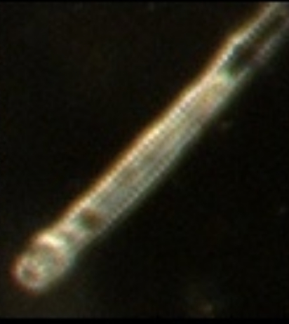 Tube Plankton